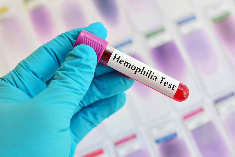 Early Warning Signs of Hemophilia