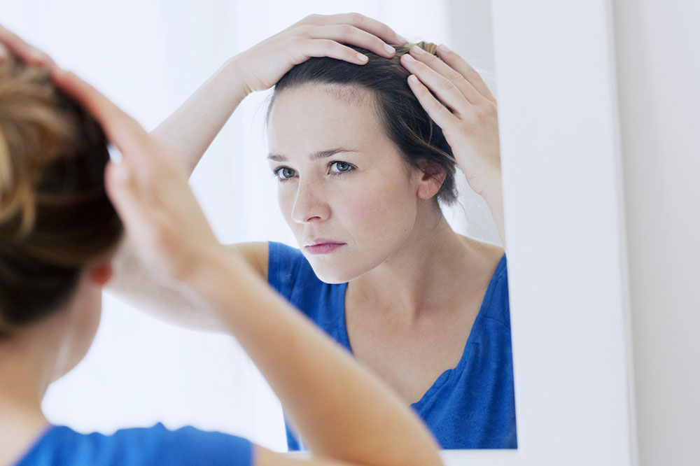 6 Tips to Prevent Hair Loss